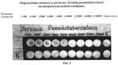 Безынструментальный способ диагностики псевдотуберкулеза (патент 2464573)