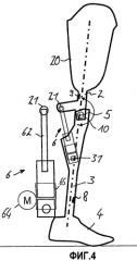 Ортопедический коленный сустав, а также способ управления ортопедическим коленным суставом (патент 2488367)