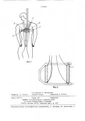 Способ крепления спасательного пояса на спасаемом объекте (патент 1391660)