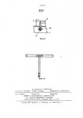 Эндопротез коленного сустава (патент 1191077)