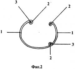 Опорное кольцо для анулопластики сердечных клапанов (патент 2300348)