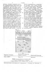 Устройство для питания электрофильтра (патент 1435298)