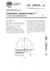 Сепарирующее устройство (патент 1204144)