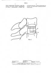 Эндопротез сегмента позвоночника (патент 1560184)