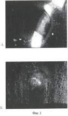 Способ флуоресцентной диагностики поражений роговицы (патент 2355285)
