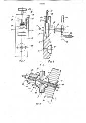 Устройство для остеосинтеза переломов трубчатых костей (патент 1127580)
