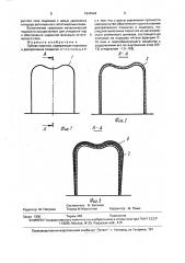 Зубная коронка (патент 1644944)