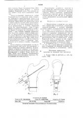 Направляющее устройство для введениястержня при остеосинтезе (патент 843969)