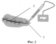Устройство для гемостаза (патент 2486874)