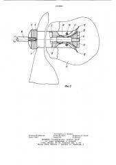 Фиксатор для остеосинтеза шейки бедренной кости (патент 1219067)