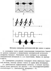 Способ ранней диагностики гипертонической болезни (патент 2313276)