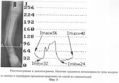 Способ фотоденситометрии рентгенограмм или их оцифрованных изображений (патент 2281030)