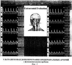 Способ диагностики ранних форм цереброваскулярной недостаточности (патент 2417756)