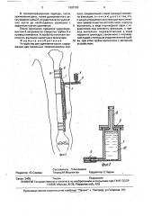 Устройство али-заде ч.а.а. для удлинения кости (патент 1683720)