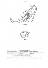 Бюгельный протез (патент 1333329)