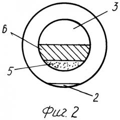Способ экстракции катаракты (патент 2260411)