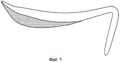 Биологический имплант переносицы и способ его изготовления (патент 2499612)