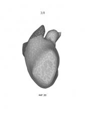 Выбор модели анатомического варианта для сегментации изображения (патент 2609084)