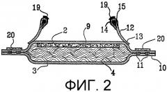 Абсорбирующее изделие, содержащее средство для кондиционирования кожи (патент 2314081)