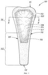 Абсорбирующее изделие с основным абсорбирующим участком, расположенным в передней части (патент 2259810)