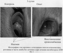 Способ лечения и профилактики глазных болезней, связанных с ишемией тканей глаза (патент 2268722)