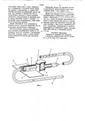 Дренаж для брюшной полости (патент 774561)
