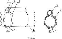 Устройство для фиксации внешнего катетера эндоскопа (патент 2553499)