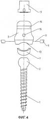 Спинальный шуруп (патент 2549017)