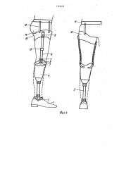 Протез голени (патент 1143416)
