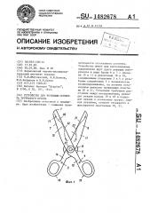 Устройство для резекции сегмента трубчатого органа (патент 1482678)