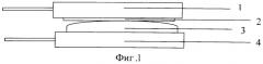 Способ лечения вывиха внутрисуставного диска височно-нижнечелюстного сустава (патент 2527841)