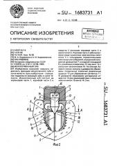 Искусственный зуб (патент 1683731)