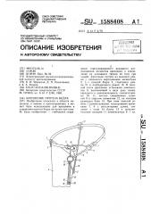 Крепление протеза бедра (патент 1588408)