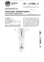 Устройство для сближения и сопоставления концов полых органов при наложении анастомоза (патент 1174006)