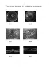 Способ лечения макулярных друз при возрастной макулодистрофии (патент 2647142)