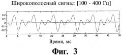 Способ генерации сигналов стимуляции для имплантируемой матрицы электродов кохлеарного имплантата (варианты) и система кохлеарного имплантата (патент 2491762)