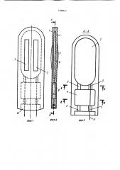 Датчик для измерения давления прикуса зубов (патент 1398825)