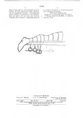 Устройство для стимулирования венозного кровообращения (патент 654255)