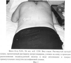 Способ стимуляции секреции инсулина (патент 2550798)