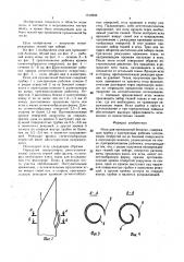 Игла для пункционной биопсии (патент 1519656)