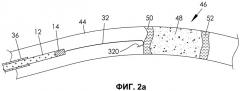 Способ и система для облегчения прохождения проволочного проводника через закупоренные протоки (патент 2539988)