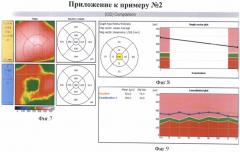 Способ комбинированного лечения диабетического диффузного макулярного отека (патент 2486878)