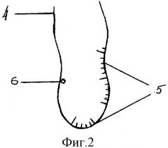 Способ протезирования створок аортального клапана и шаблоны для его осуществления (патент 2314041)