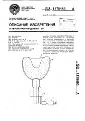 Способ снятия оттиска с зубов (патент 1175465)