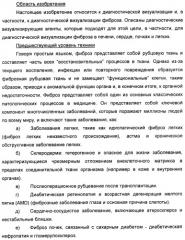 Новые визуализирующие агенты (патент 2441668)