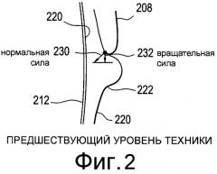 Податливые динамические зоны перемещения для контактных линз (патент 2575054)