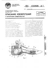 Искусственная стопа (патент 1532026)