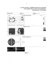 Способ лечения морфометрических изменений макулярной области при полиморбидных соматических состояниях (патент 2622759)