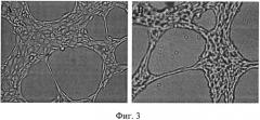 Производные индолокарбазолов, блокирующие васкулогенную мимикрию в опухоли (патент 2557554)