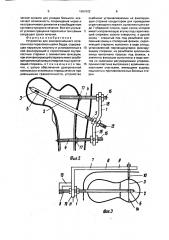 Устройство для компрессионного остеосинтеза переломов шейки бедра (патент 1664302)